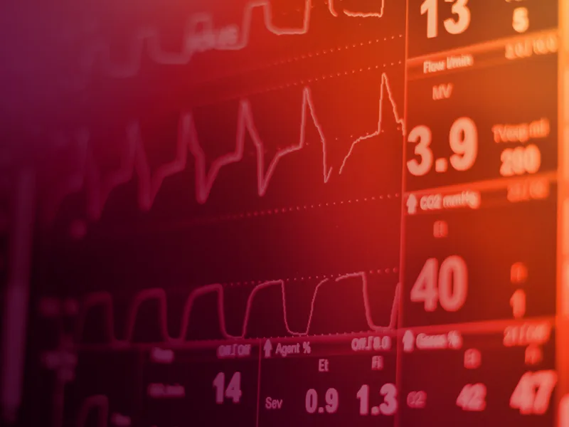 Close-up of medical monitoring equipment displaying patient vital signs and waveforms on a digital screen.